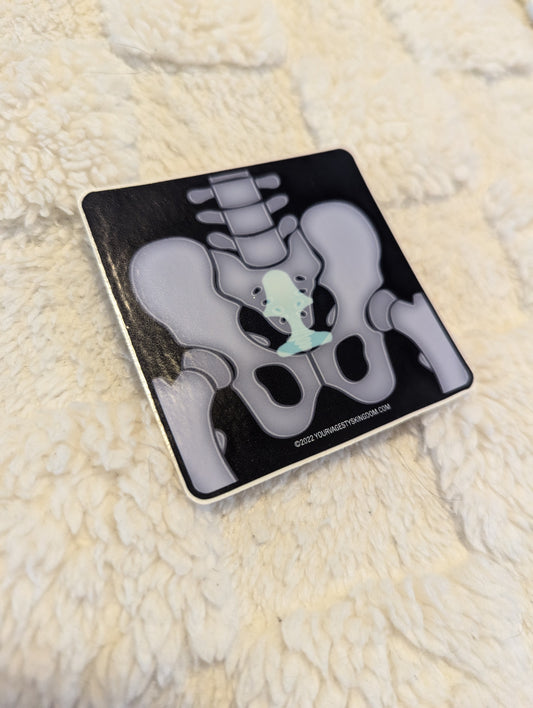 X-Ray Butt Plug Skeleton Sticker